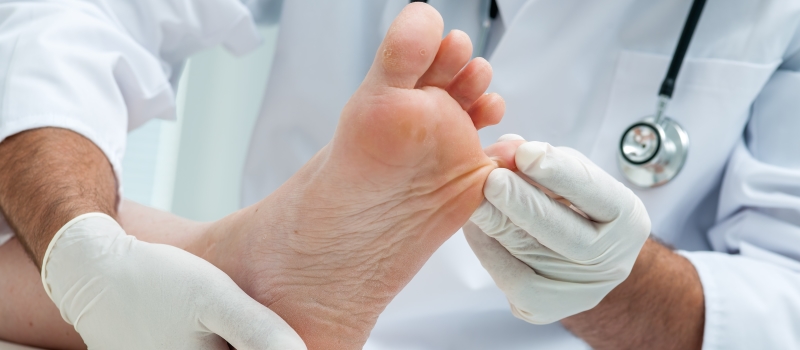 What is Diabetic Foot, its Symptoms and Signs of Neuropathy?